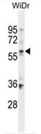 Beta,beta-carotene 15,15 -monooxygenase antibody, AP50362PU-N, Origene, Western Blot image 