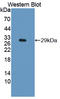 DIX Domain Containing 1 antibody, LS-C374967, Lifespan Biosciences, Western Blot image 