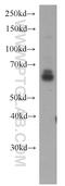 NADPH Oxidase 4 antibody, 14347-1-AP, Proteintech Group, Western Blot image 