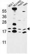 Canopy FGF Signaling Regulator 2 antibody, AP50990PU-N, Origene, Western Blot image 