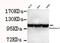 Hexokinase 2 antibody, GTX49233, GeneTex, Western Blot image 