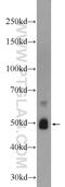 Zinc Finger RANBP2-Type Containing 2 antibody, 24816-1-AP, Proteintech Group, Western Blot image 