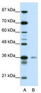 High mobility group protein 20A antibody, TA345242, Origene, Western Blot image 