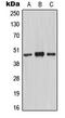 Mannan Binding Lectin Serine Peptidase 1 antibody, LS-C352727, Lifespan Biosciences, Western Blot image 