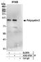 Polycystin-2 antibody, A302-470A, Bethyl Labs, Immunoprecipitation image 
