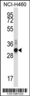 Zinc finger protein-like 1 antibody, 57-634, ProSci, Western Blot image 