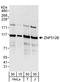 Zinc Finger Protein 512B antibody, A303-236A, Bethyl Labs, Western Blot image 