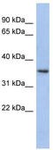 Peroxisomal Biogenesis Factor 7 antibody, TA335139, Origene, Western Blot image 