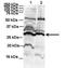 Proteasome Subunit Beta 6 antibody, NBP1-56575, Novus Biologicals, Western Blot image 