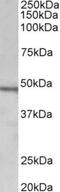 Chitotriosidase-1 antibody, NBP1-97774, Novus Biologicals, Western Blot image 