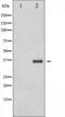 CCAAT Enhancer Binding Protein Beta antibody, TA325358, Origene, Western Blot image 