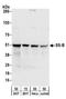 Small RNA Binding Exonuclease Protection Factor La antibody, A303-902A, Bethyl Labs, Western Blot image 