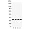 Nucleophosmin/Nucleoplasmin 2 antibody, R31097, NSJ Bioreagents, Western Blot image 