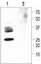 Aquaporin 2 antibody, TA329014, Origene, Western Blot image 
