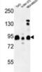 SH3 Domain GRB2 Like Endophilin Interacting Protein 1 antibody, abx034420, Abbexa, Western Blot image 