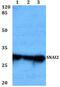 Snail Family Transcriptional Repressor 2 antibody, PA5-75681, Invitrogen Antibodies, Western Blot image 