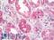 Prostate Stem Cell Antigen antibody, LS-B10930, Lifespan Biosciences, Immunohistochemistry frozen image 