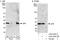 Eukaryotic Translation Initiation Factor 6 antibody, A303-030A, Bethyl Labs, Immunoprecipitation image 