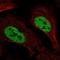 Solute Carrier Family 4 Member 3 antibody, HPA063498, Atlas Antibodies, Immunofluorescence image 