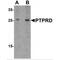 Protein Tyrosine Phosphatase Receptor Type D antibody, MBS150763, MyBioSource, Western Blot image 