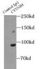 Catenin Beta 1 antibody, FNab00882, FineTest, Immunoprecipitation image 