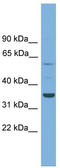 Chromosome 3 Open Reading Frame 67 antibody, TA339832, Origene, Western Blot image 