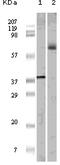 ETS Transcription Factor ELK1 antibody, 32-149, ProSci, Western Blot image 