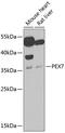 Peroxisomal targeting signal 2 receptor antibody, 22-574, ProSci, Western Blot image 