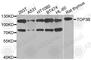 DNA Topoisomerase III Beta antibody, A8469, ABclonal Technology, Western Blot image 