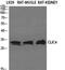 Chloride Intracellular Channel 4 antibody, PA5-50935, Invitrogen Antibodies, Western Blot image 