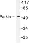 Parkin RBR E3 Ubiquitin Protein Ligase antibody, AP06276PU-N, Origene, Western Blot image 