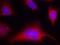 Protein Kinase D1 antibody, GTX38601, GeneTex, Immunofluorescence image 