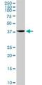 Syntaxin 18 antibody, H00053407-D01P, Novus Biologicals, Western Blot image 