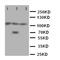 ATPase Sarcoplasmic/Endoplasmic Reticulum Ca2+ Transporting 1 antibody, orb76233, Biorbyt, Western Blot image 