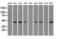 Protein Phosphatase 1 Regulatory Subunit 7 antibody, LS-C797103, Lifespan Biosciences, Western Blot image 