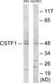 Cleavage Stimulation Factor Subunit 1 antibody, EKC1777, Boster Biological Technology, Western Blot image 
