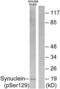 Synuclein antibody, LS-C199631, Lifespan Biosciences, Western Blot image 