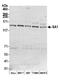 Stromal Antigen 1 antibody, A300-156A, Bethyl Labs, Western Blot image 