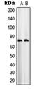 Solute Carrier Family 25 Member 12 antibody, LS-C353068, Lifespan Biosciences, Western Blot image 