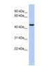 Zinc Finger Protein 566 antibody, NBP1-80126, Novus Biologicals, Western Blot image 