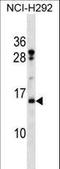Histone Cluster 2 H2B Family Member F antibody, LS-C166903, Lifespan Biosciences, Western Blot image 