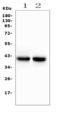 Gap Junction Protein Alpha 4 antibody, A05569, Boster Biological Technology, Western Blot image 