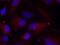 P21 (RAC1) Activated Kinase 2 antibody, GTX50867, GeneTex, Immunofluorescence image 