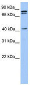SUZ12 Polycomb Repressive Complex 2 Subunit antibody, TA345171, Origene, Western Blot image 