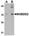 Rhomboid domain-containing protein 2 antibody, NBP1-76249, Novus Biologicals, Western Blot image 