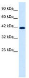 Potassium voltage-gated channel subfamily KQT member 2 antibody, TA338754, Origene, Western Blot image 