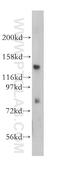 Erythrocyte Membrane Protein Band 4.1 antibody, 13014-1-AP, Proteintech Group, Western Blot image 