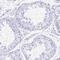 Chromosome 12 Open Reading Frame 56 antibody, NBP2-30788, Novus Biologicals, Immunohistochemistry paraffin image 