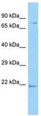 FUN14 Domain Containing 2 antibody, TA331758, Origene, Western Blot image 