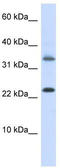Homeobox protein EMX1 antibody, TA342411, Origene, Western Blot image 